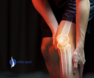 Blogbeitrag: „Aktiv bleiben mit dem neuen Gelenk. Sport mit Knie- oder Hüftendoprothese“
